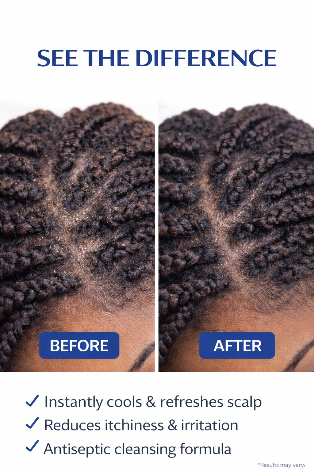 J. AMILA Natural Cool Scalp Refresher with Menthol, Myrrh, Vitamin E & Argan Oil – Cooling Scalp Spray for Braids, Wigs, Natural & Synthetic Hair (8 oz)