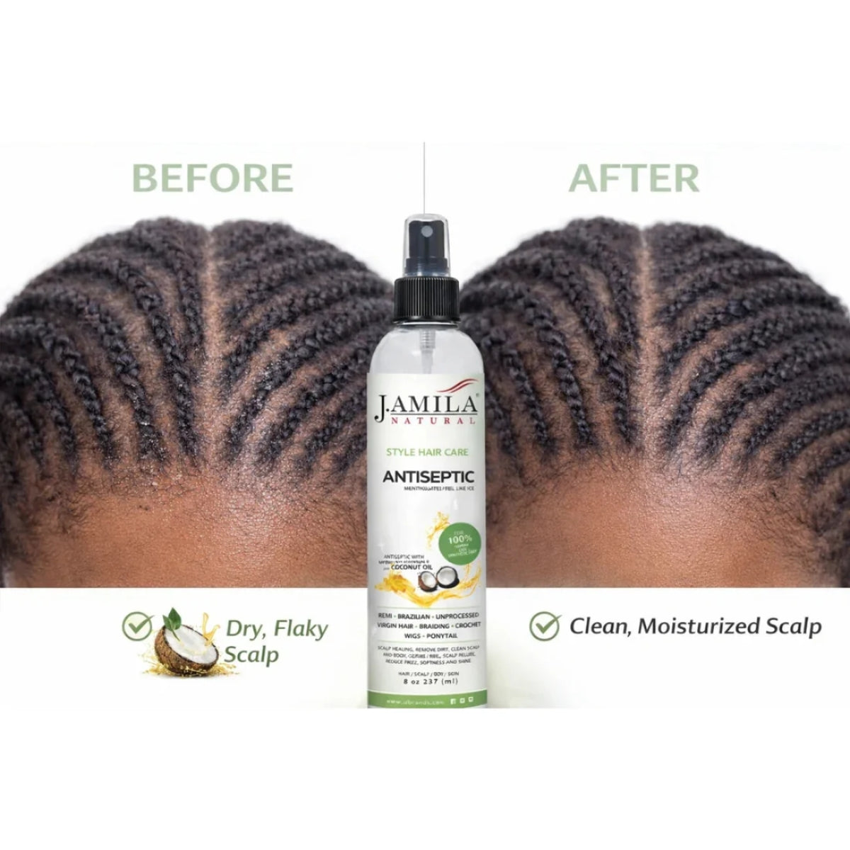 J. Amila Natural Antiseptic Spray with Coconut Oil – Mentholated Scalp Relief, Itch Control & Scalp Detox for Wigs, Braids & Natural Hair (8 oz / 237 ml)
