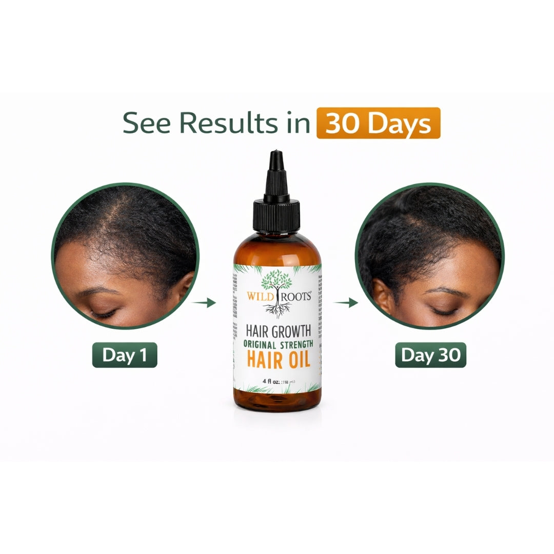 Wild Roots Original Strength Hair Growth Oil – Nourishing Scalp Treatment for Thicker, Stronger Hair (4oz)