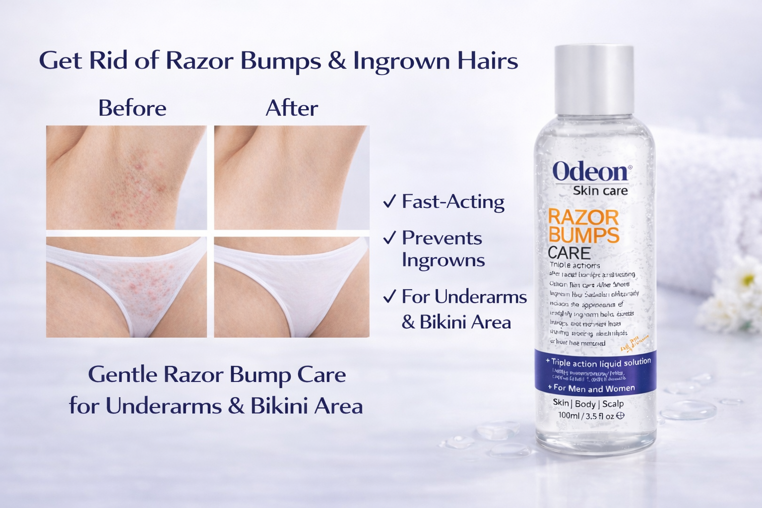ODEON® Razor Bumps Care & Skin and Scalp Treatment Duo – Ingrown Hair & Irritation Relief (2 x 3.5 fl oz)