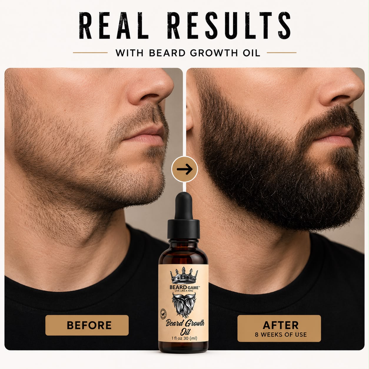 Beard Game Beard Growth Oil | Fuller, Softer & Healthier Beard