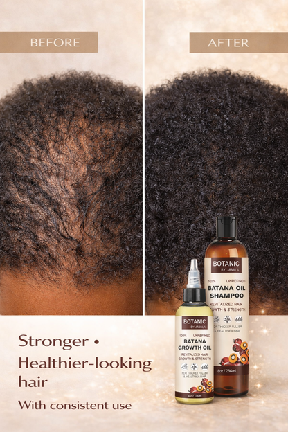 Botanic Hair Care. 100% Unrefined Scalp &amp; Growth Treatment Bundle
