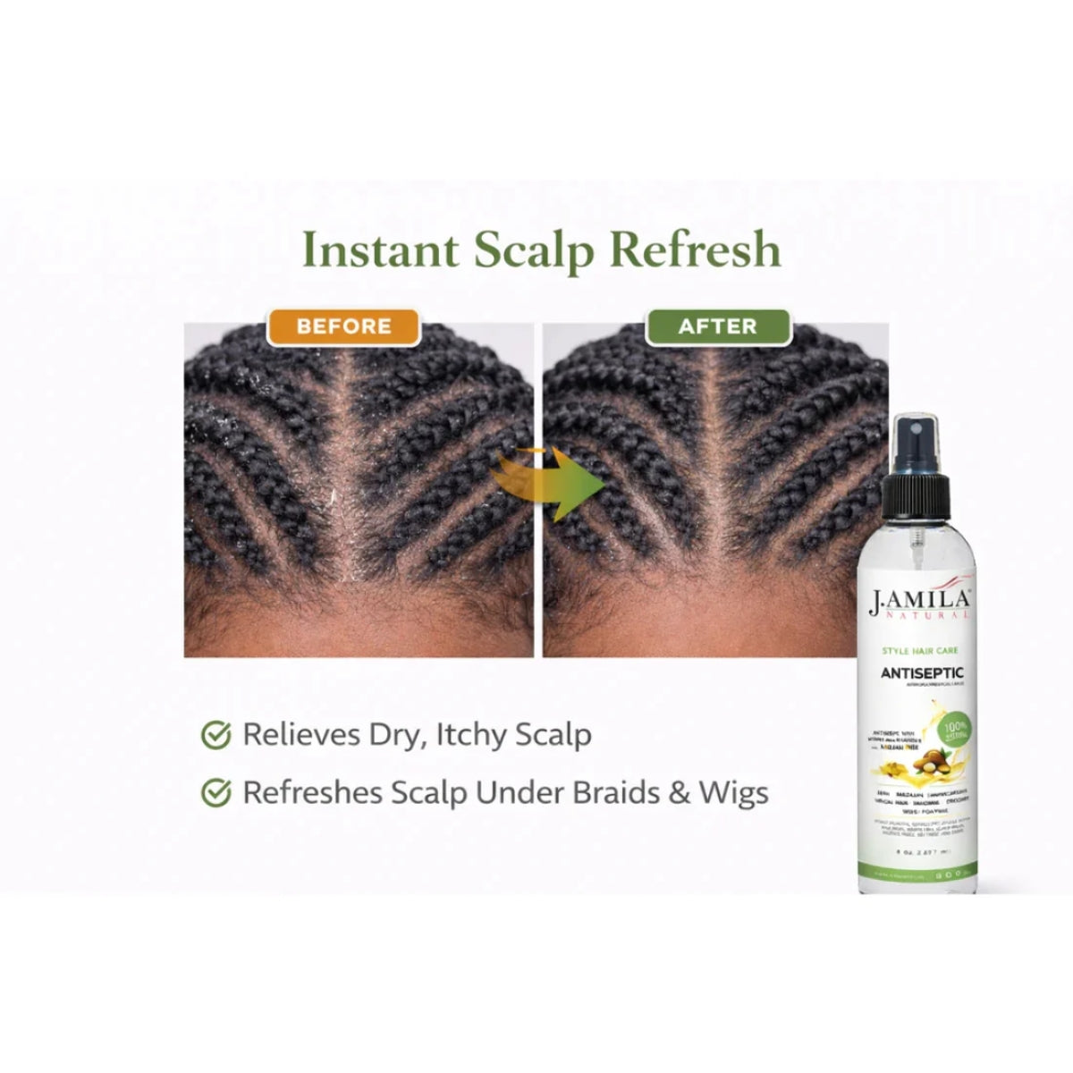 J. Amila Natural Antiseptic Spray with Argan Oil &amp; Myrrh – Scalp Relief, Itch Control &amp; Cleanse for Wigs, Braids &amp; Natural Hair (8 oz / 237 ml)