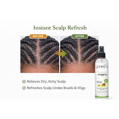 J. Amila Natural Antiseptic Spray with Argan Oil &amp; Myrrh – Scalp Relief, Itch Control &amp; Cleanse for Wigs, Braids &amp; Natural Hair (8 oz / 237 ml)