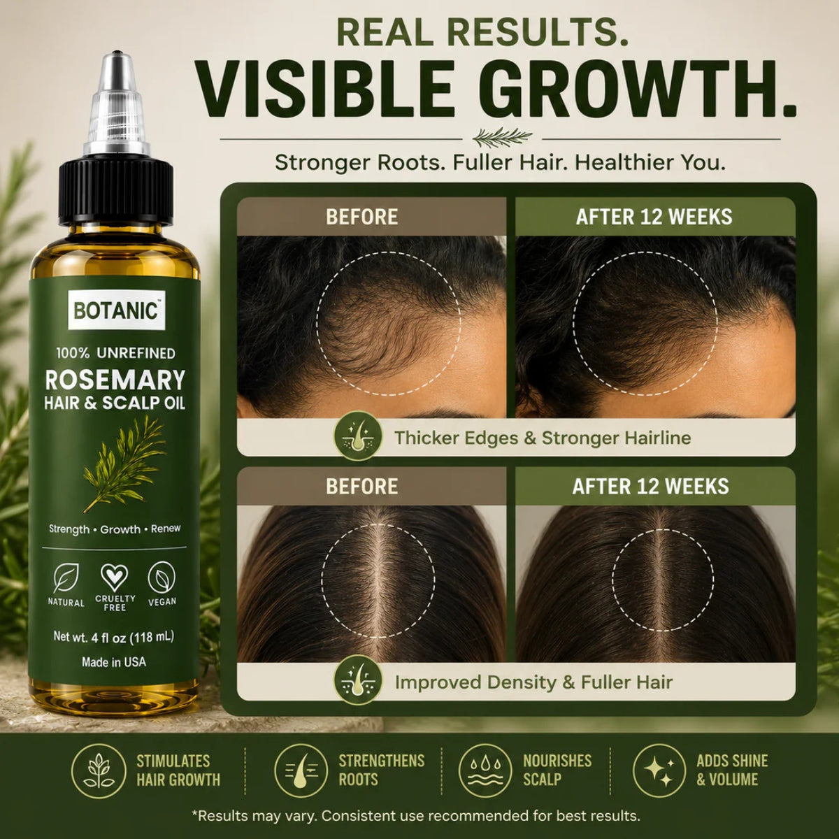 BOTANIC 100% Unrefined Rosemary Hair &amp; Scalp Oil – Hair Growth &amp; Scalp Nourishing Treatment – 4 fl oz (118 mL)