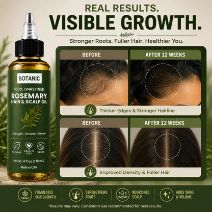 BOTANIC 100% Unrefined Rosemary Hair &amp; Scalp Oil – Hair Growth &amp; Scalp Nourishing Treatment – 4 fl oz (118 mL)