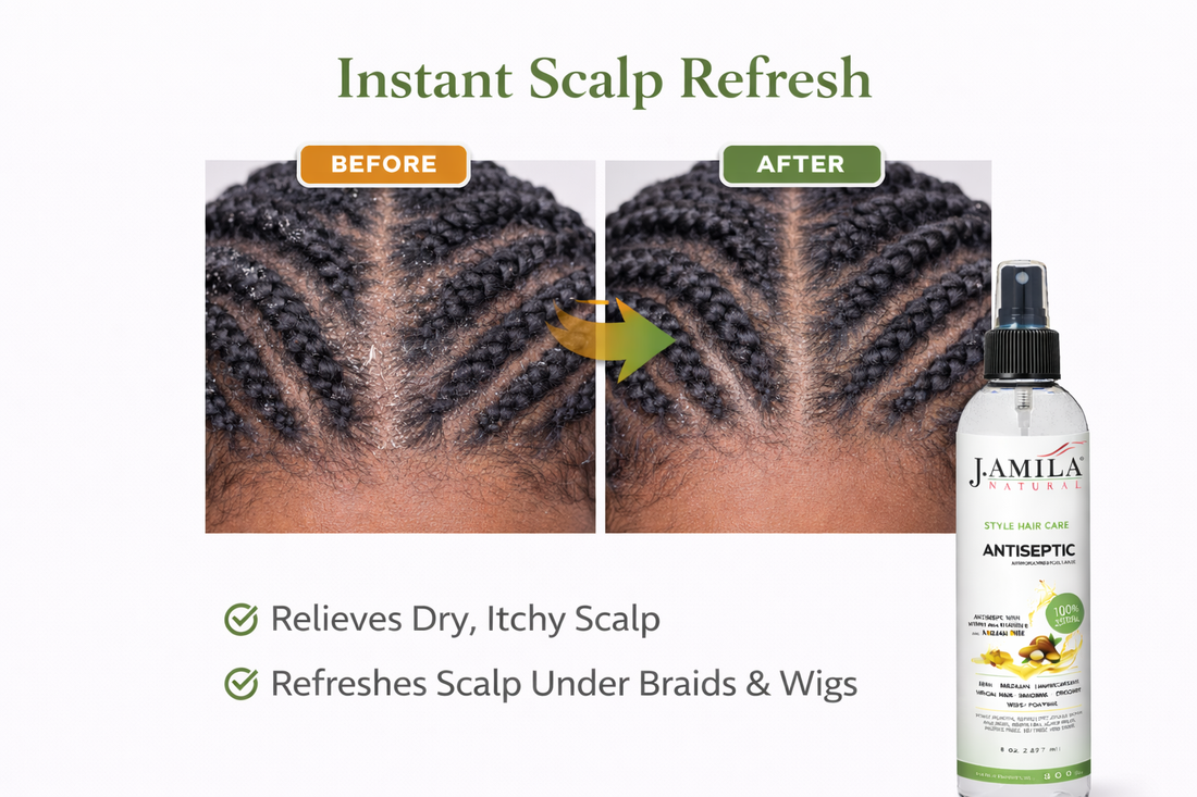 J. Amila Natural Antiseptic Spray with Argan Oil &amp; Myrrh – Scalp Relief, Itch Control &amp; Cleanse for Wigs, Braids &amp; Natural Hair (8 oz / 237 ml)