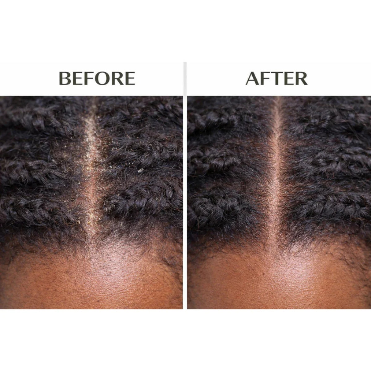 J. Amila Natural Antiseptic Spray with Olive Oil – Mentholated Scalp Relief, Itch Control &amp; Scalp Detox for Wigs, Braids &amp; Natural Hair (8 oz / 237 ml)