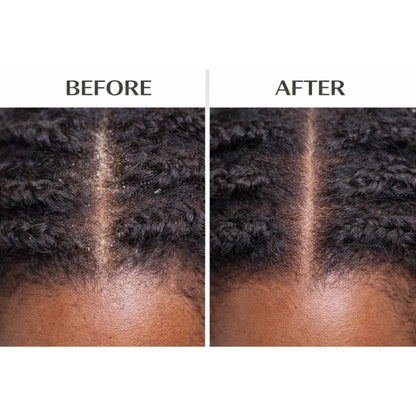 J. Amila Natural Antiseptic Spray with Olive Oil – Mentholated Scalp Relief, Itch Control &amp; Scalp Detox for Wigs, Braids &amp; Natural Hair (8 oz / 237 ml)