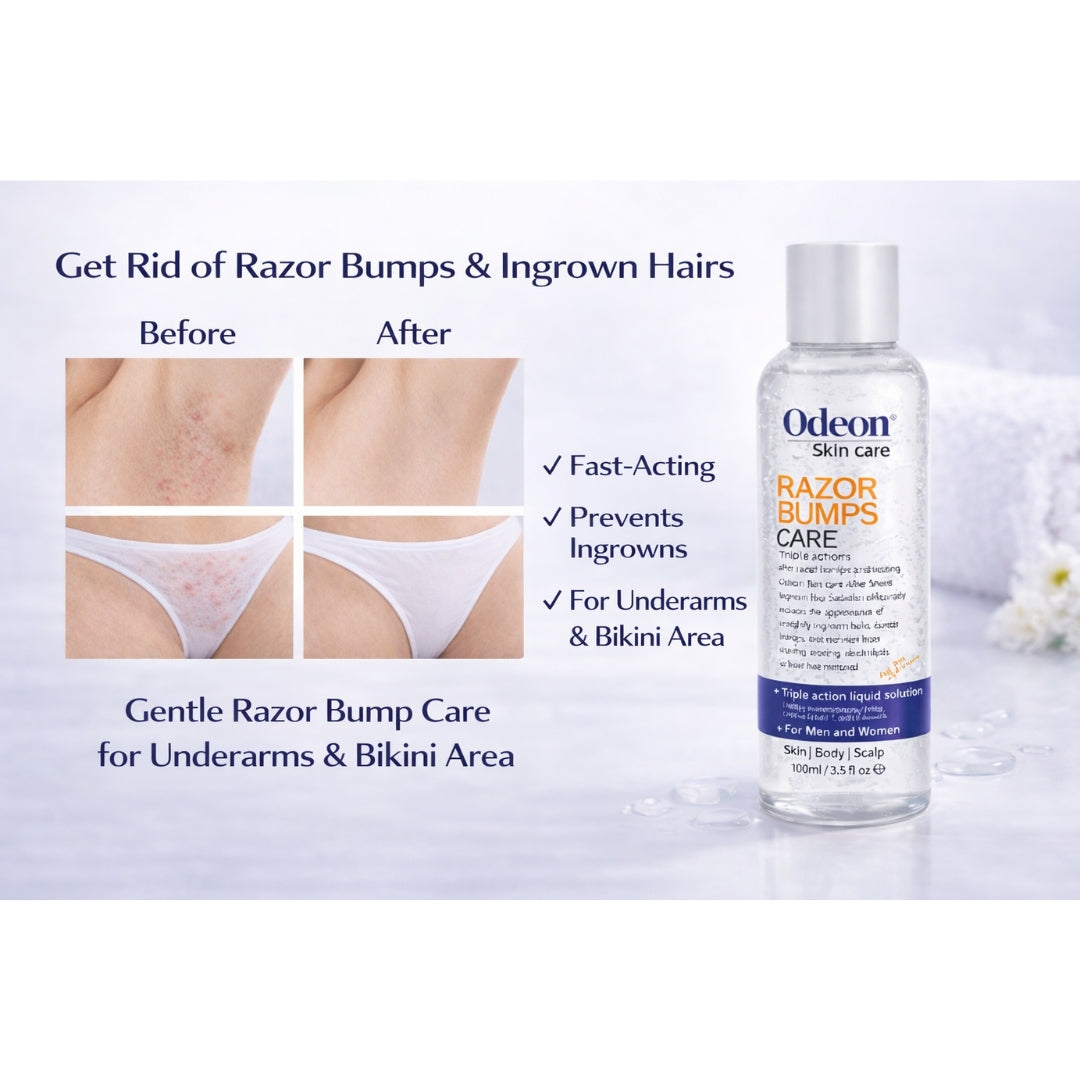 Odeon® Professional Razor Bumps Treatment Liquid – Ingrown Hair &amp; Irritation Relief (3.5 oz)