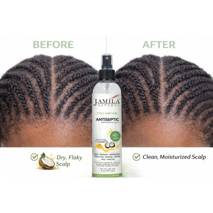 J. Amila Natural Antiseptic Spray with Coconut Oil – Mentholated Scalp Relief, Itch Control &amp; Scalp Detox for Wigs, Braids &amp; Natural Hair (8 oz / 237 ml)