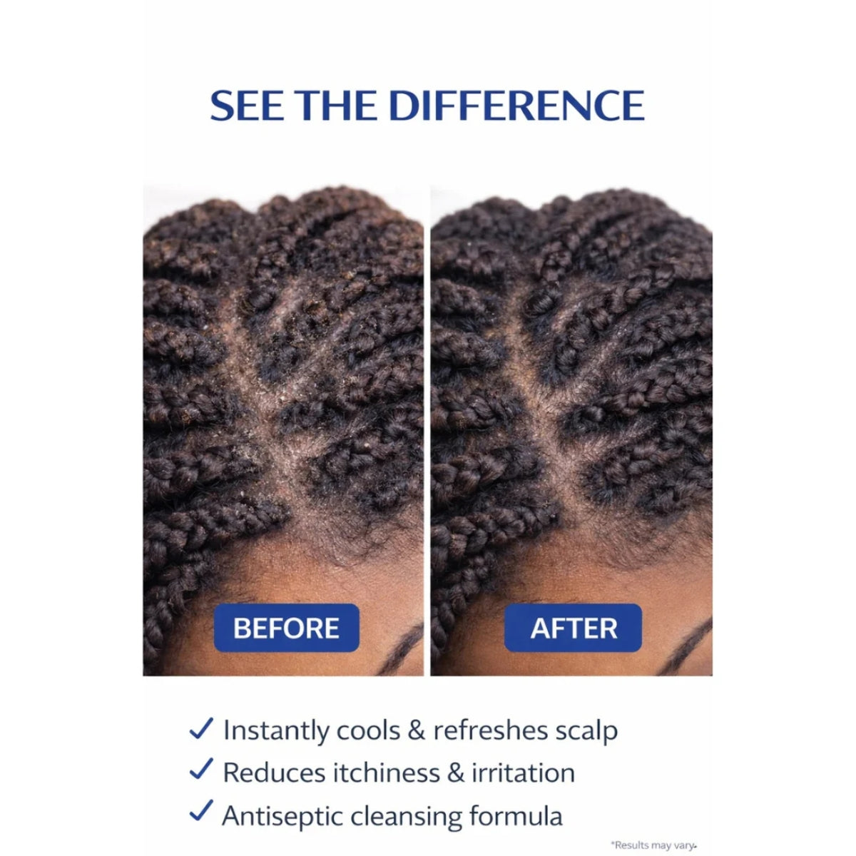 J. AMILA Natural Cool Scalp Refresher with Menthol, Myrrh, Vitamin E &amp; Argan Oil – Cooling Scalp Spray for Braids, Wigs, Natural &amp; Synthetic Hair (8 oz)