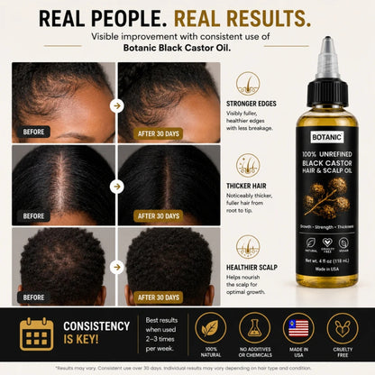 BOTANIC 100% Unrefined Black Castor Hair &amp; Scalp Oil – Hair Growth &amp; Thickness Treatment – 4 fl oz (118 mL)