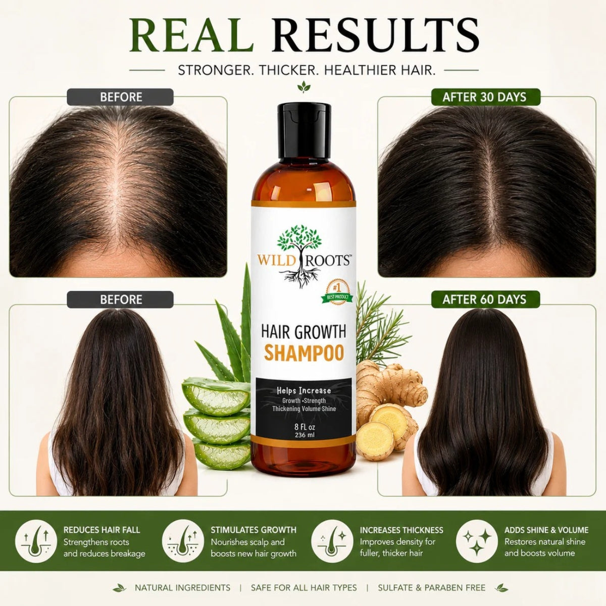 Wild Roots Hair Growth Shampoo – Strengthening &amp; Thickening Formula for Fuller, Healthier Hair (8oz)