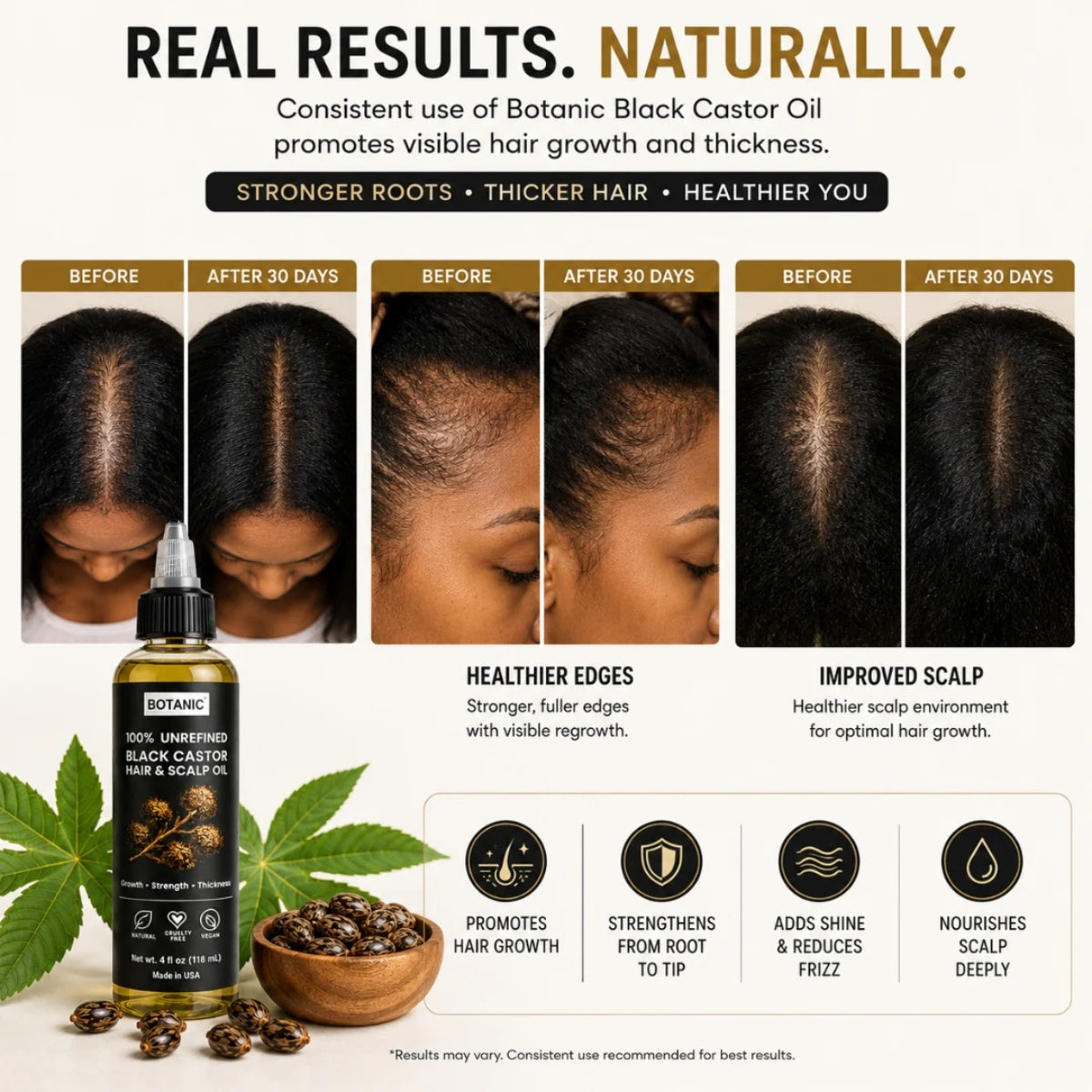 BOTANIC 100% Unrefined Black Castor Hair &amp; Scalp Oil – Hair Growth &amp; Thickness Treatment – 4 fl oz (118 mL)