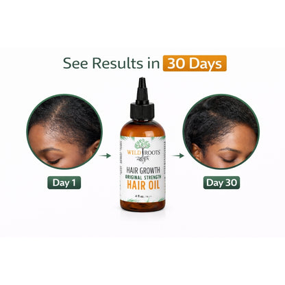 Wild Roots Original Strength Hair Growth Oil – Nourishing Scalp Treatment for Thicker, Stronger Hair (4oz)