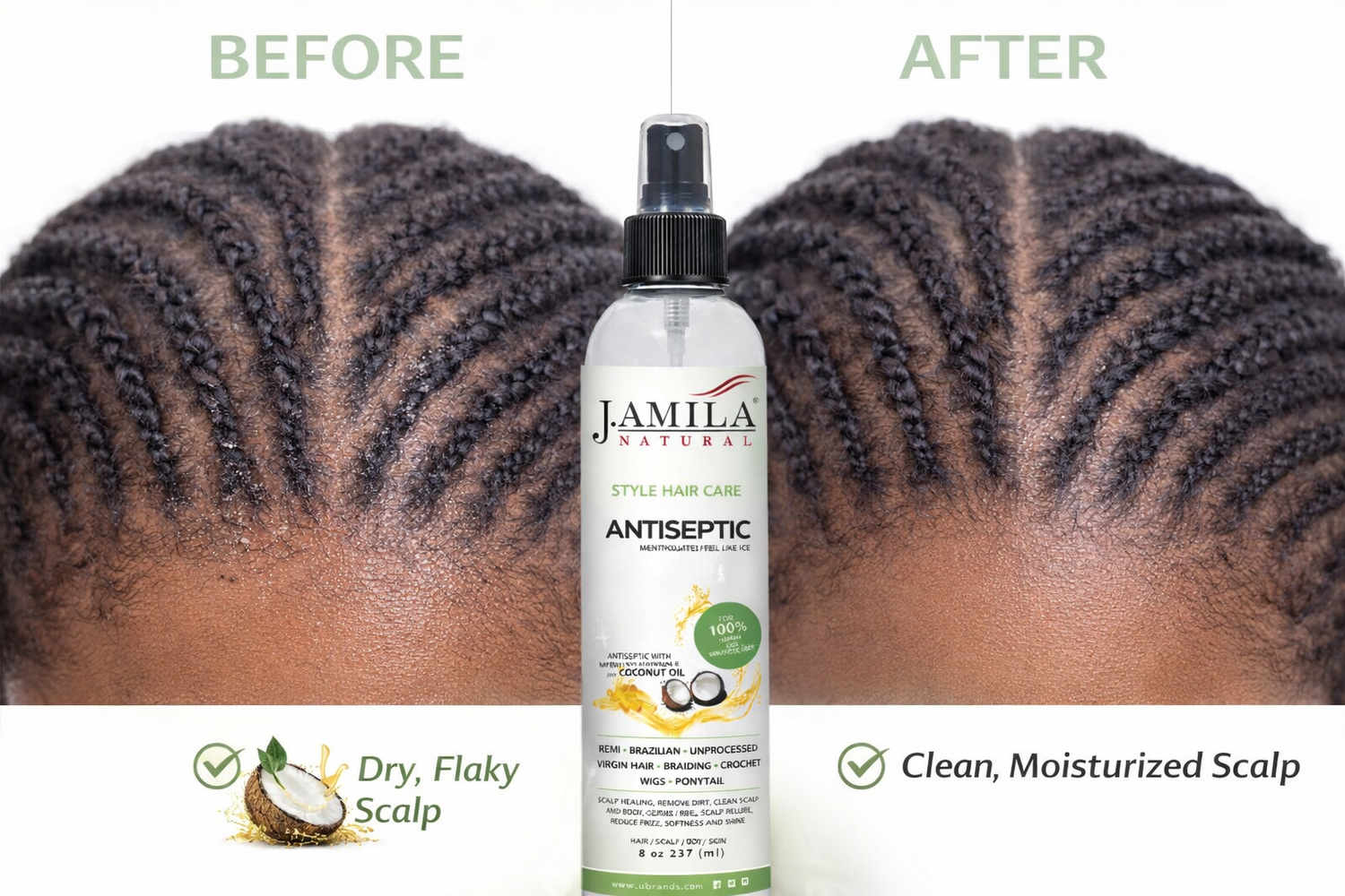 J. Amila Natural Antiseptic Spray with Coconut Oil – Mentholated Scalp Relief, Itch Control &amp; Scalp Detox for Wigs, Braids &amp; Natural Hair (8 oz / 237 ml)