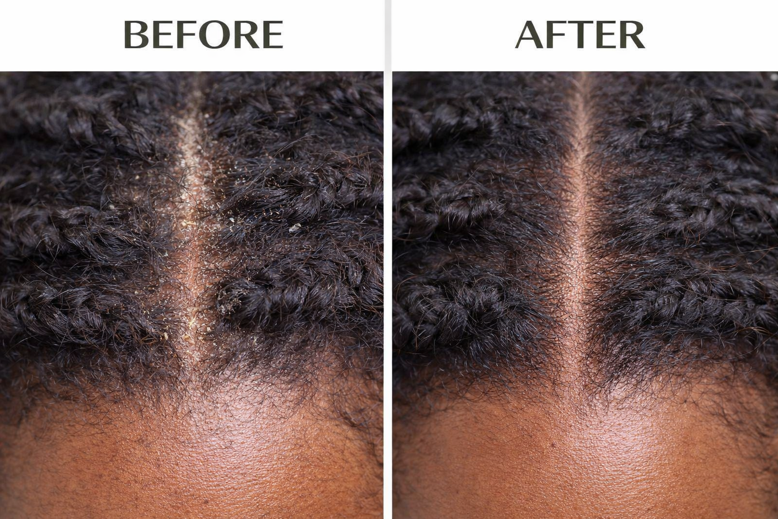 J. Amila Natural Antiseptic Spray with Olive Oil – Mentholated Scalp Relief, Itch Control &amp; Scalp Detox for Wigs, Braids &amp; Natural Hair (8 oz / 237 ml)