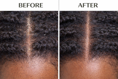 J. Amila Natural Antiseptic Spray with Olive Oil – Mentholated Scalp Relief, Itch Control &amp; Scalp Detox for Wigs, Braids &amp; Natural Hair (8 oz / 237 ml)