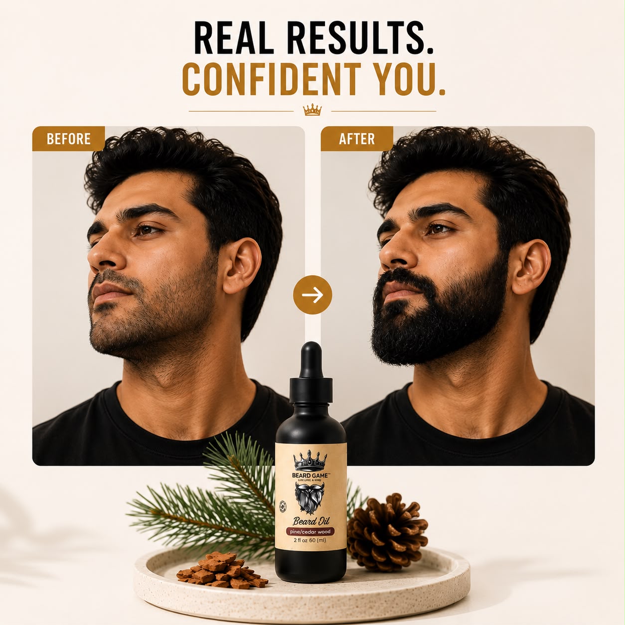 Beard Game Pine &amp; Cedarwood Beard Oil | Soften, Condition &amp; Nourish