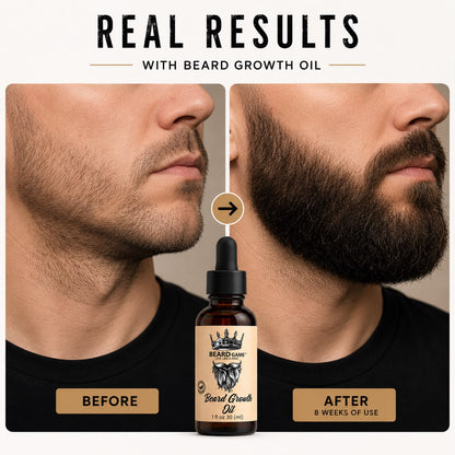 Beard Game Beard Growth Oil | Fuller, Softer &amp; Healthier Beard