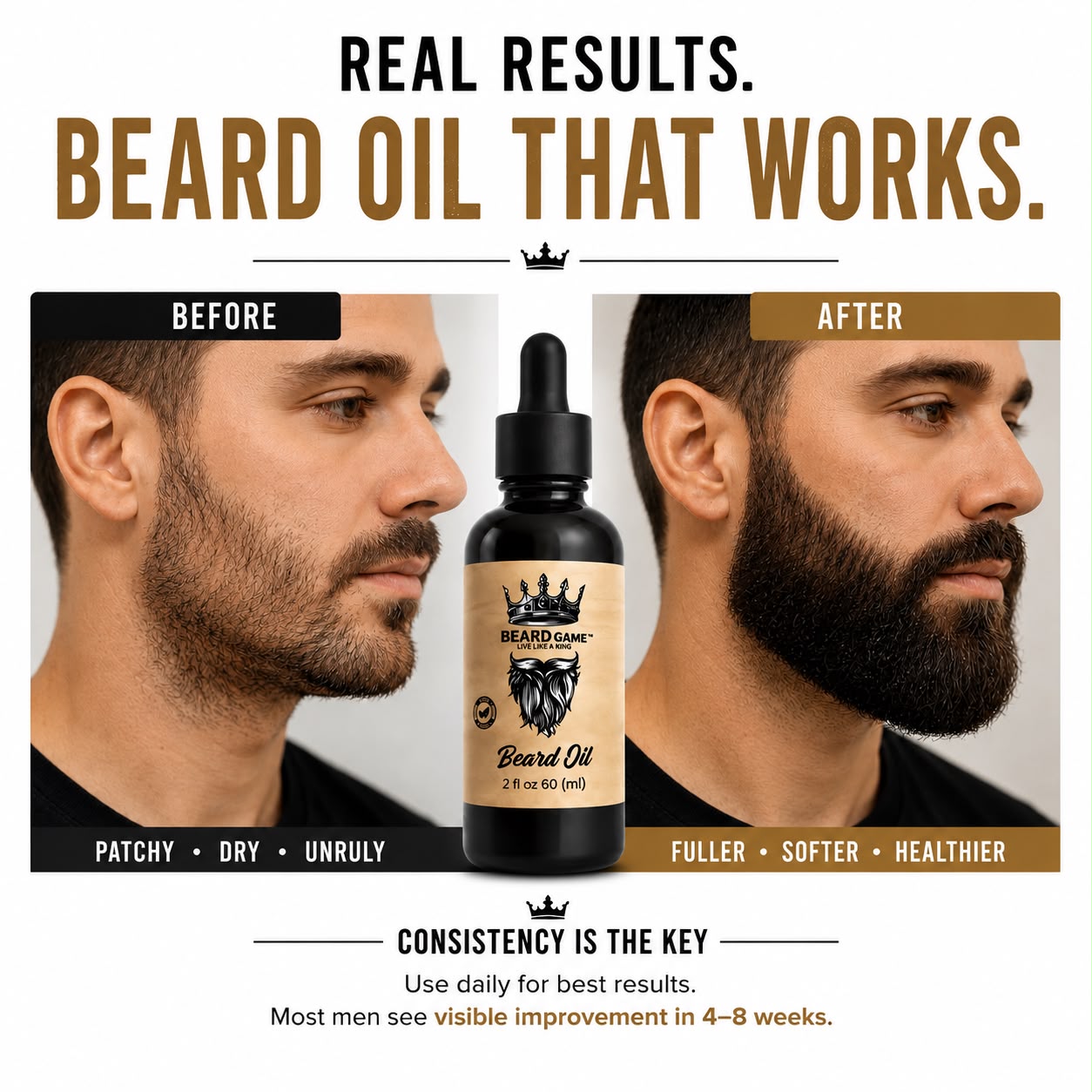 Beard Game Premium Beard Oil | Soft, Healthy &amp; Well-Groomed Beard