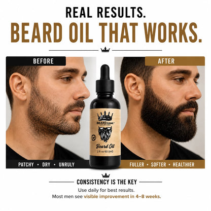 Beard Game Premium Beard Oil | Soft, Healthy &amp; Well-Groomed Beard